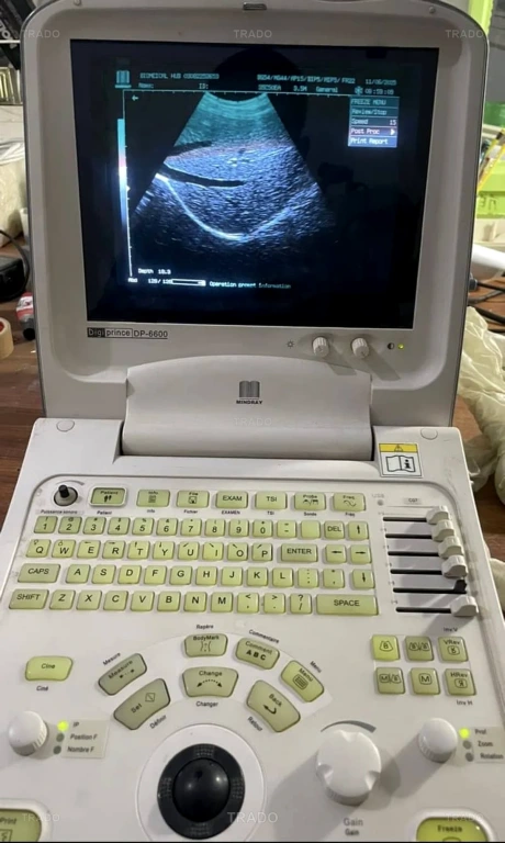 Ultrasound Machine for Sale in Karachi